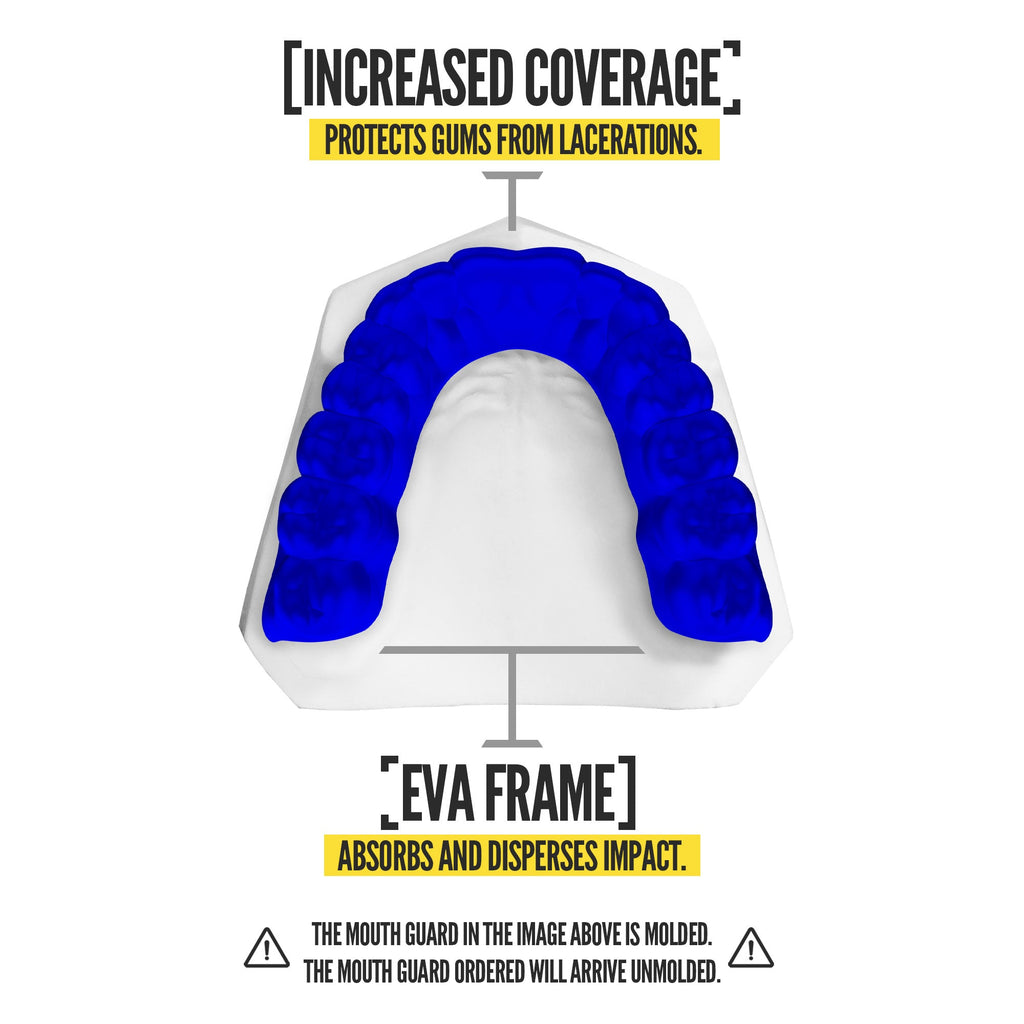 Nxtrnd Classic® Blue (2 Pack)